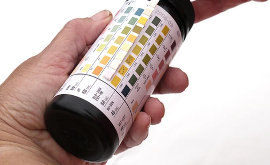 Center Of Quality In Medical Laboratories Urine Dipsticks Analysis Instruction Sheet 8847